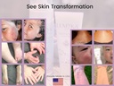 rosacea-cream--face-redness-relief-facia-5.jpg