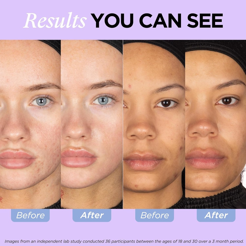 zitsticka-vitamin-acne-supplement-for-cy-4.jpg