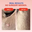 fifth-fido-lipoma-treatment-for-dogs---d-2.jpg