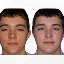 acne-pills-30-day--supplements-for-acne--5.jpg