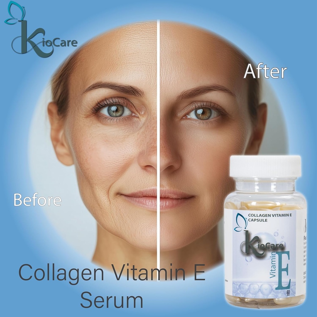 kiocare-vitamin-e-oil-for-face-skin-care-3.jpg