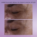 lancome-renergie-hcf-triple-serum-eye-an-2.jpg