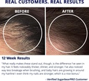 sugarbearpro-hair-vitamin-gummy-1-month--6.jpg
