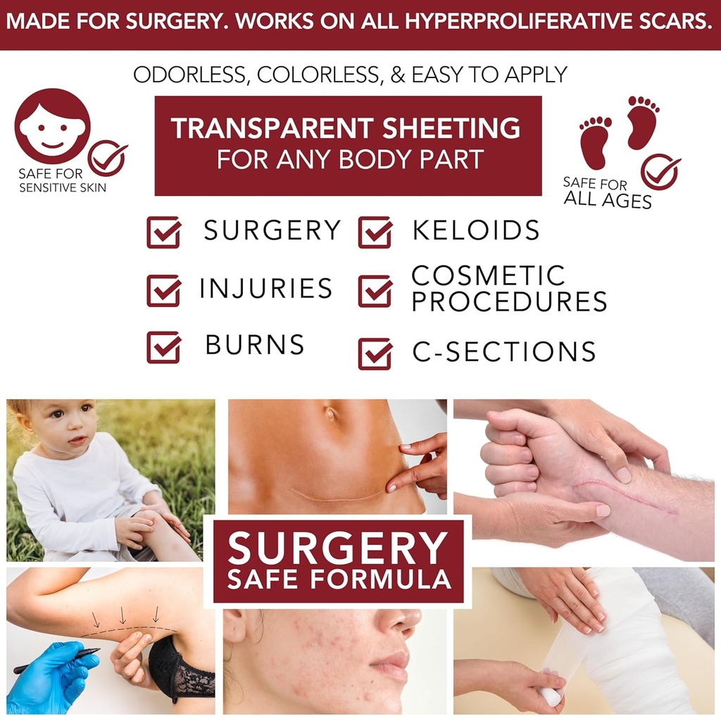 physician-formulated-silicone-scar-gel-s-4.jpg