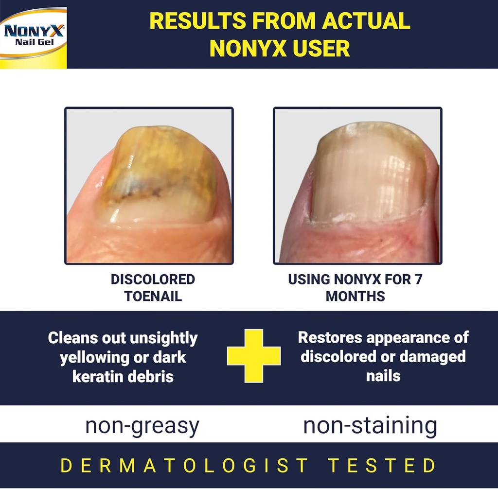 nonyx-fungal-nail-clarifying-gel-clinica-2.jpg