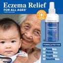 skinsmart-antimicrobial-eczema-therapy-w-5.jpg